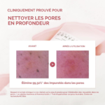 ⁦SKIN1004 - Poremizing Deep Cleansing Foam – 125 ml⁩ - الصورة ⁦4⁩